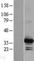 PYCR2 Human Over-expression Lysates NM_013328