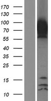 ls029924 epsin 1 epn1 human over expression lysates nm 001130072 wb testing 3