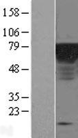 ls029924 epsin 1 epn1 human over expression lysates nm 013333 wb testing 1