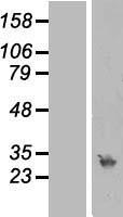 RPA4 Human Over-expression Lysates NM_013347