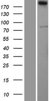 ls029946 sertad3 human over expression lysates nm 013368 wb testing 1