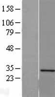 ls029950 sertad1 human over expression lysates nm 013376 wb testing 1