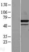 DPP2 (DPP7) Human Over-expression Lysates NM_013379