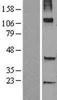 TRHDE Human Over-expression Lysates NM_013381