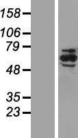 MADM (NRBP1) Human Over-expression Lysates NM_013392