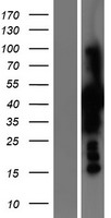 Phosphoserine Aminotransferase (PSAT1) Human Over-expression Lysates NM_058179