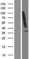 UBQLN2 Human Over-expression Lysates NM_013444