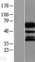 Ubiquilin (UBQLN1) Human Over-expression Lysates NM_013438