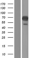 Ubiquilin (UBQLN1) Human Over-expression Lysates NM_053067