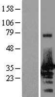 NRBF2 Human Over-expression Lysates NM_030759
