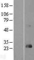 RHOD Human Over-expression Lysates NM_014578