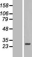 SLC39A3 Human Over-expression Lysates NM_144564