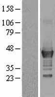 LMCD1 Human Over-expression Lysates NM_014583