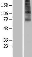 ls029999 fascin 3 fscn3 human over expression lysates nm 020369 wb testing 1