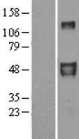 EFEMP2 Human Over-expression Lysates NM_016938