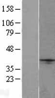 NXPH1 Human Over-expression Lysates NM_152745