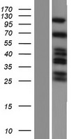 SH3KBP1 Human Over-expression Lysates NM_001024666