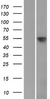 SOX8 Human Over-expression Lysates NM_014587