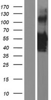VSX1 Human Over-expression Lysates NM_014588