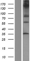 EMR2 (ADGRE2) Human Over-expression Lysates NM_152918