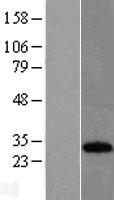 CSEN (KCNIP3) Human Over-expression Lysates NM_013434