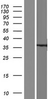 KChIP2 (KCNIP2) Human Over-expression Lysates NM_014591