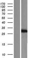 KChIP2 (KCNIP2) Human Over-expression Lysates NM_173191