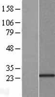 KCNIP1 Human Over-expression Lysates NM_014592
