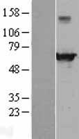 ls030844 ehd4 human over expression lysates nm 139265 wb testing 1