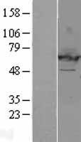 EHD2 Human Over-expression Lysates NM_014601