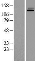 PI 3 Kinase regulatory subunit 4 (PIK3R4) Human Over-expression Lysates NM_014602