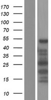 CDRL2 (CDR2L) Human Over-expression Lysates NM_014603