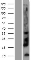 Kallikrein 12 (KLK12) Human Over-expression Lysates NM_145895