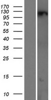 ZNF295 (ZBTB21) Human Over-expression Lysates NM_001098403