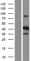 p53R2 (RRM2B) Human Over-expression Lysates NM_015713