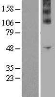 NADPH oxidase 4 (NOX4) Human Over-expression Lysates NM_016931