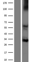 NOX3 Human Over-expression Lysates NM_015718