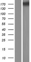 Collagen V (COL5A3) Human Over-expression Lysates NM_015719