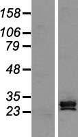 ls050511 scp3 sycp3 human over expression lysates nm 153694 wb testing 2