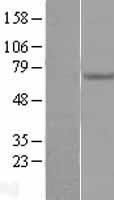 Endoglycan (PODXL2) Human Over-expression Lysates NM_015720
