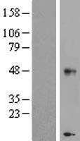 CHST11 Human Over-expression Lysates NM_018413