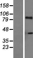 IL21 Receptor (IL21R) Human Over-expression Lysates NM_181078