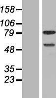 DEF6 Human Over-expression Lysates NM_022047
