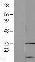 CYHR1 Human Over-expression Lysates NM_001129888