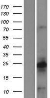 Calcyon (CALY) Human Over-expression Lysates NM_015722