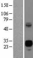 Neurogenin3 (NEUROG3) Human Over-expression Lysates NM_020999