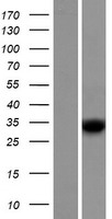RDH8 Human Over-expression Lysates NM_015725