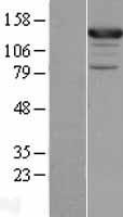 ASAP1 Human Over-expression Lysates NM_018482