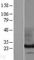 ls050810 hdgfl3 human over expression lysates nm 016073 wb testing 1