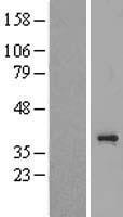 TAS2R3 Human Over-expression Lysates NM_016943